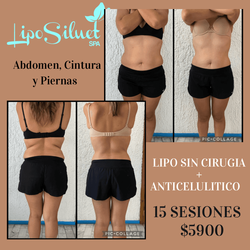 Liposiluet Spa Guadalajara photo