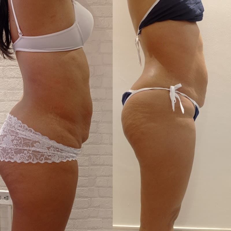 Lovelly SPA encantadora al natural Bello photo