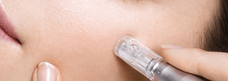 Luminous Medical Skin Care Reno photo