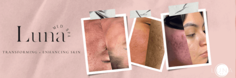 Luna Esthetics & Wellness Kansas City photo