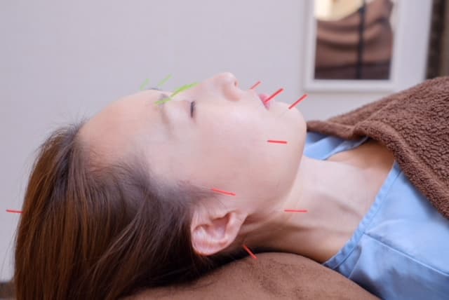 Luna Sole Beauty Acupuncture Salon Tsuzuki Ward, Yokohama City photo