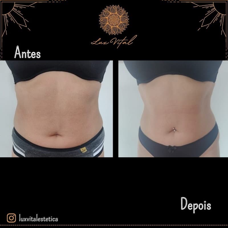 Lux Vital Terapia Botucatu photo