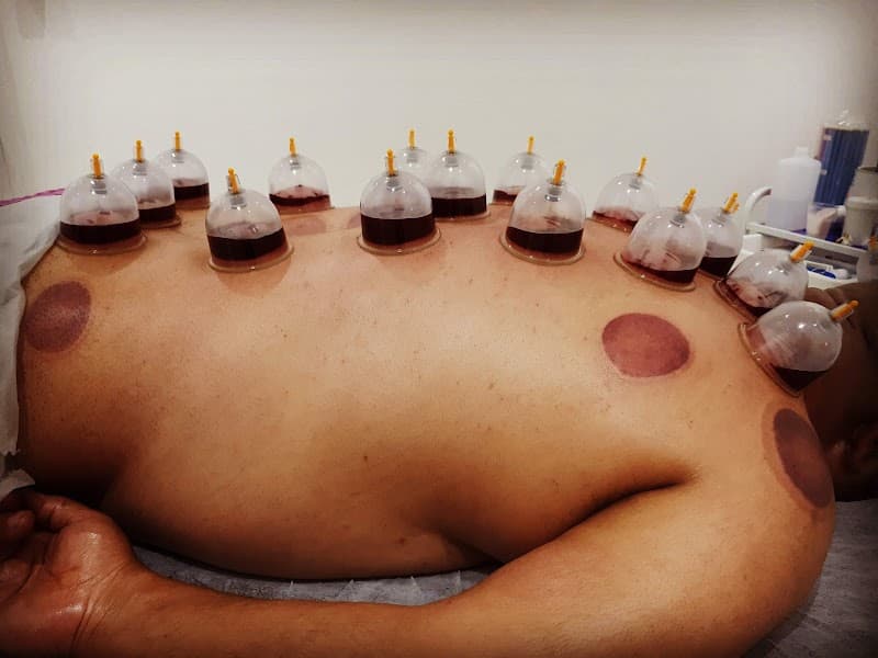 Ma'akum for Hijama and Complementary Medicine Umm al-Fahm photo