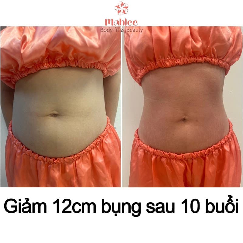 Mahlee Beauty Centre - Body Fit & Beauty Quận Đống Đa photo