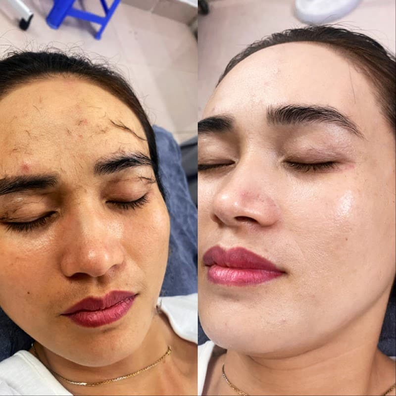 Mani Spa Bắc Ninh photo