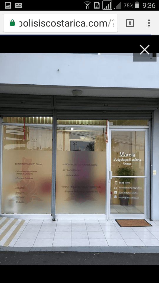 Marcia Bodyshape estetica Guacima photo