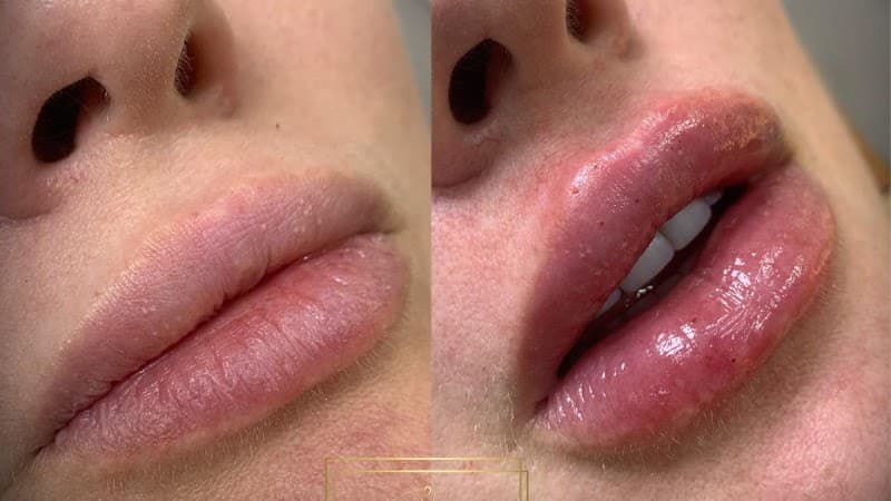 Mary Estética Corpo e Rosto Fortaleza photo