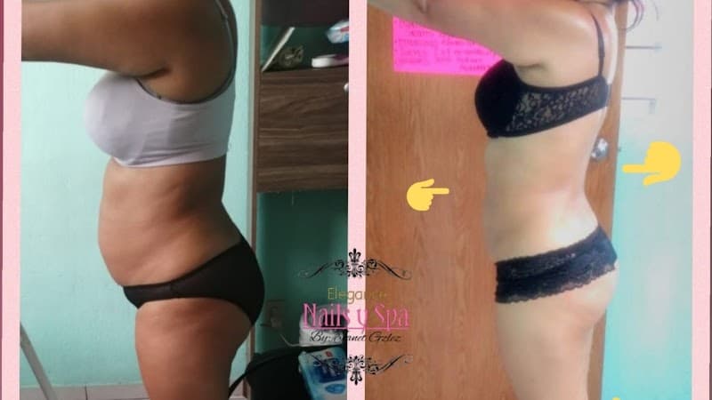 Masajes Reductivos Silueta De Envidia Guadalajara photo