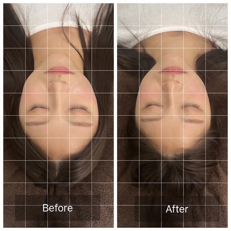 Matsumoto Osteopathic Clinic Acupuncture Clinic Toyonaka City photo