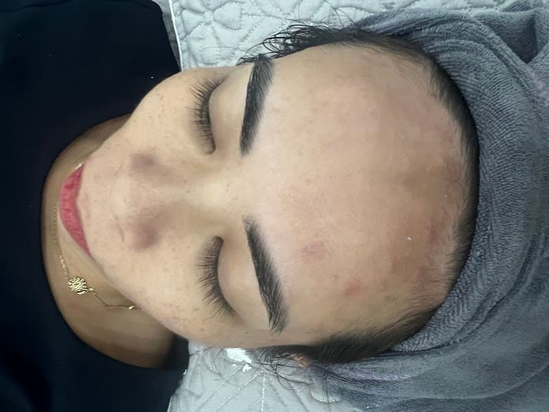Mẹ Của Tôm Spa Quận Lê Chân photo