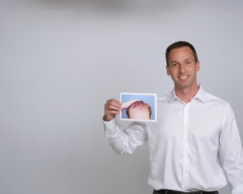 Medical Hair Restoration St. Louis photo