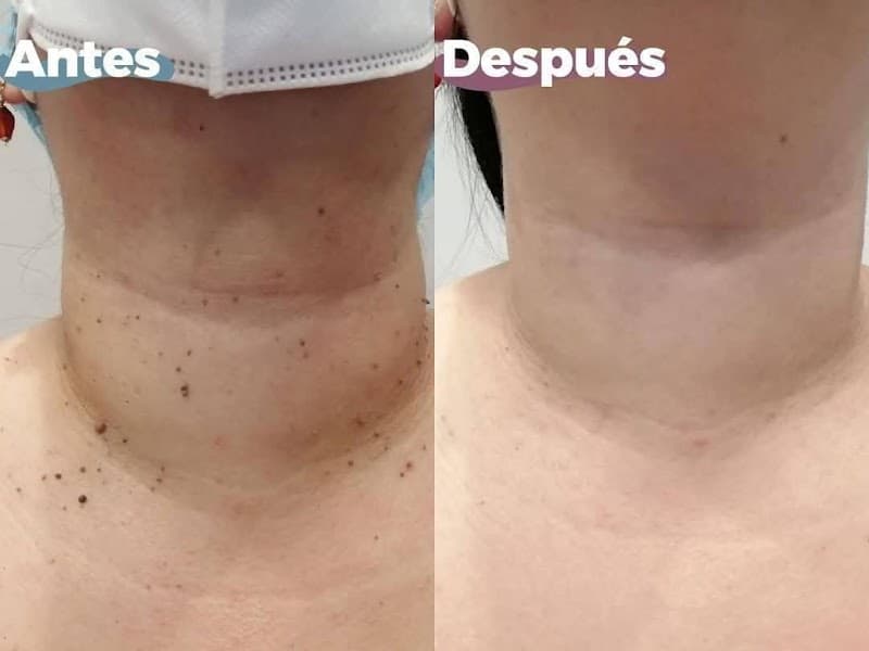 Medicina Estética & Antiage Mio Tempo Mérida photo