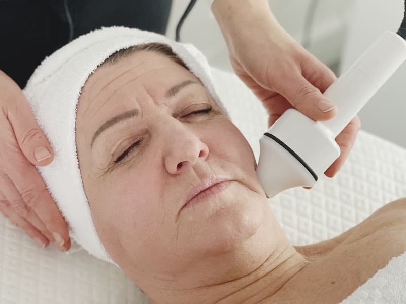 Microneedling | Entspannungsbehandlung Karlsruhe, Innenstadt-West photo