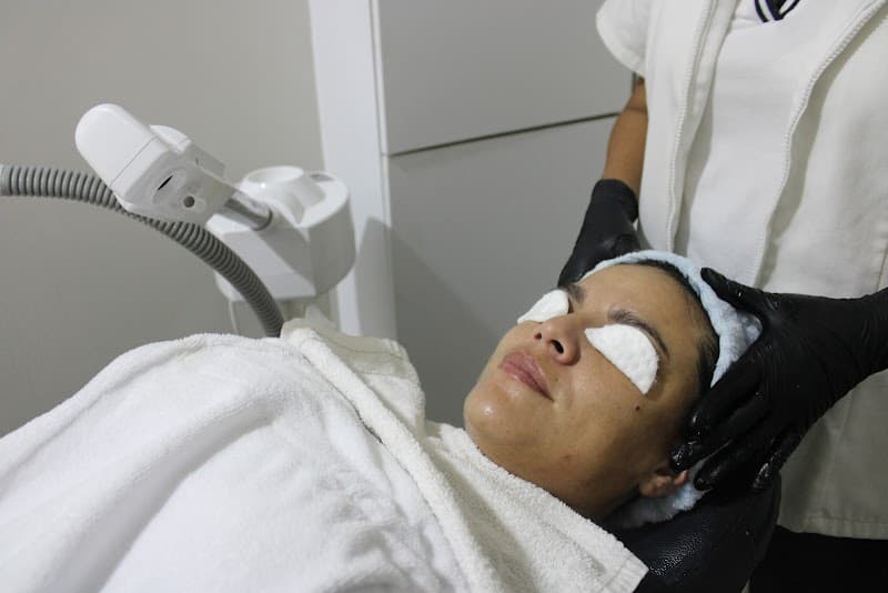 Micropuntura Estrada Zapopan photo