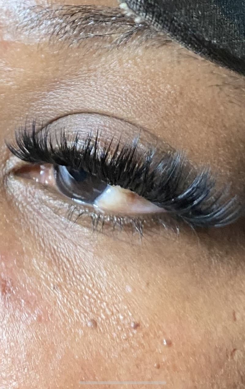 Million Dollar Body Sculpting Arlington photo