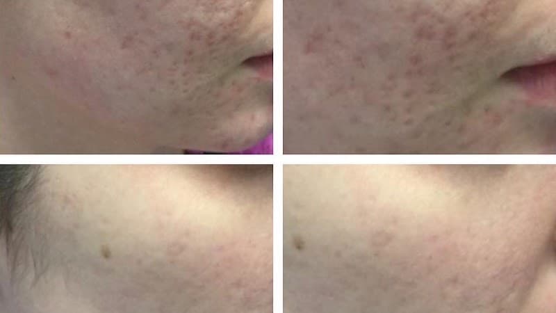 Mirta Moyano Skin Care & Body Spa Long Beach photo