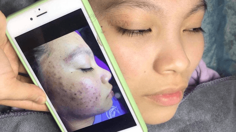 Miss M Spa Quận Gò Vấp photo