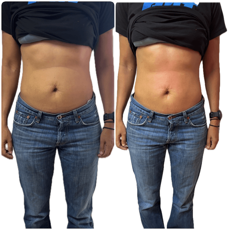 Modern Body Sculpting Spa El Paso photo