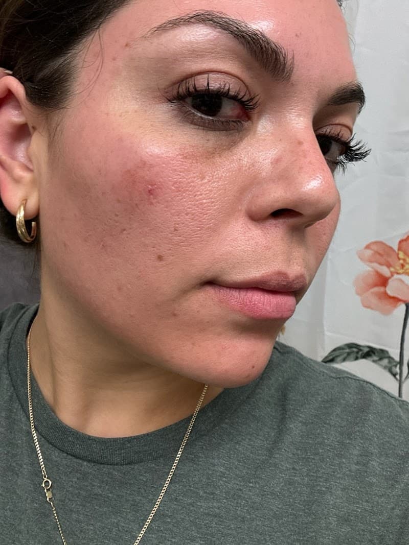 Moonstone - Skincare & Spa Katy photo