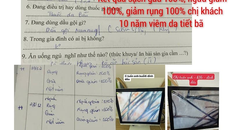 Moore Spa - Gội đầu Trị liệu Gàu Nấm Ngứa Đà Nẵng Quận Thanh Khê photo