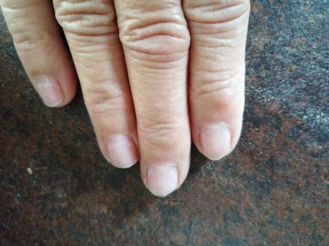 Troyes morgan' esthetique photo