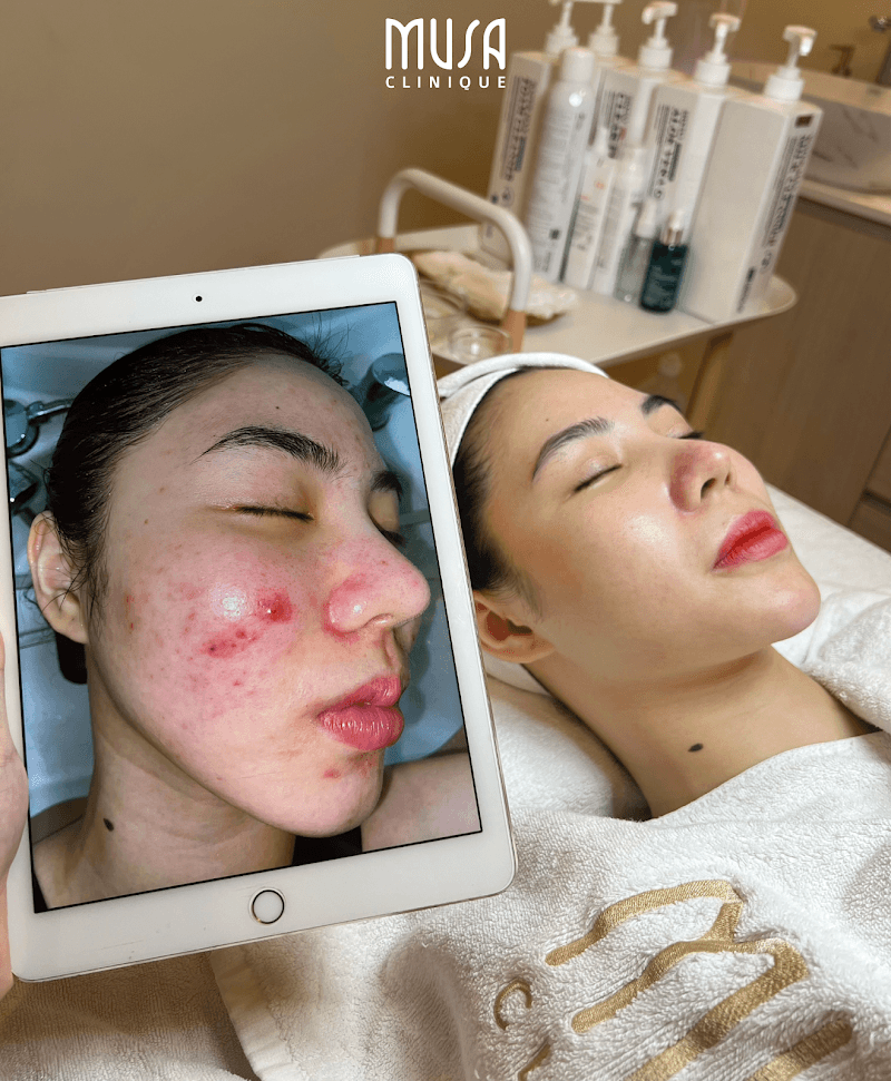 Musa Clinique Room Quận Cầu Giấy photo