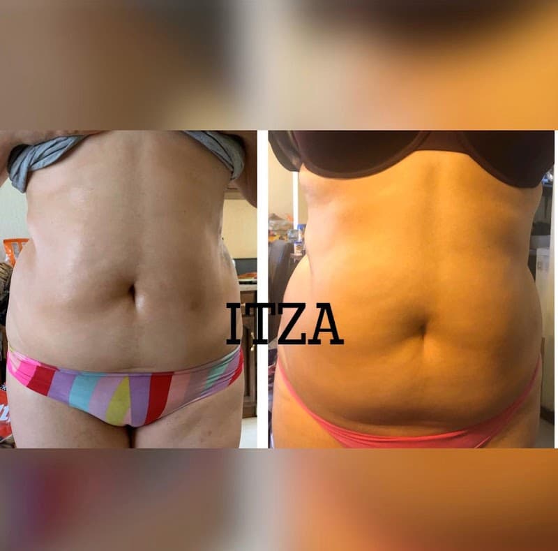 Nadyra Spa y Microblanding Tijuana photo