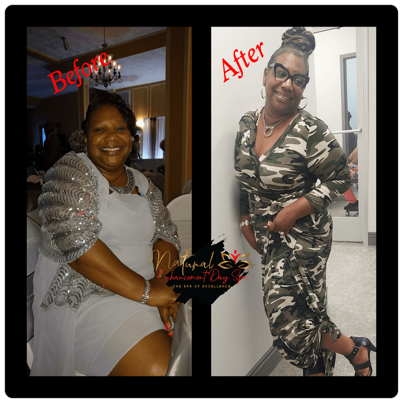 Natural Enhancement Day Spa Greensboro photo
