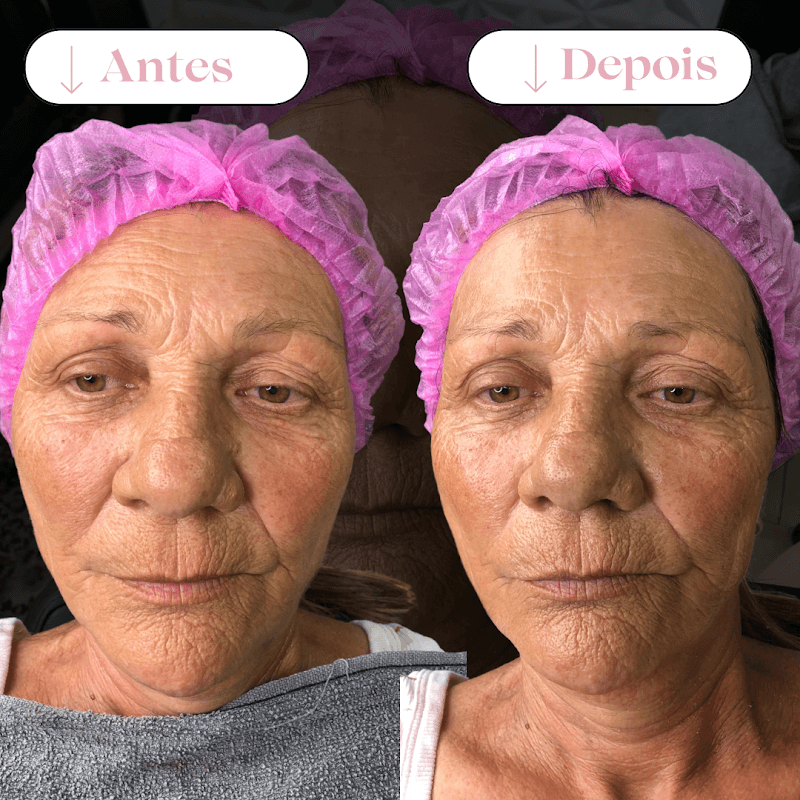 Naturallaser Centro Estético Gravataí photo