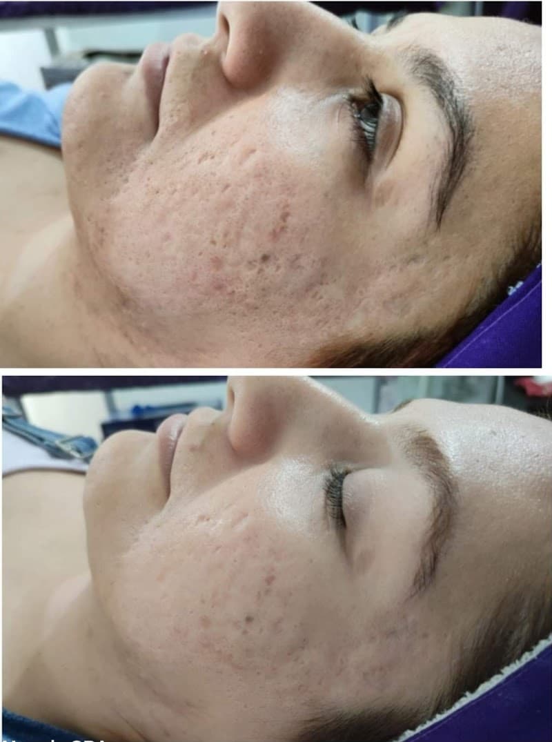 Nena's Spa Mexicali photo