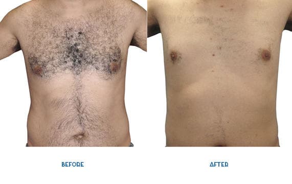Neolaia Medi Spa Sydney photo
