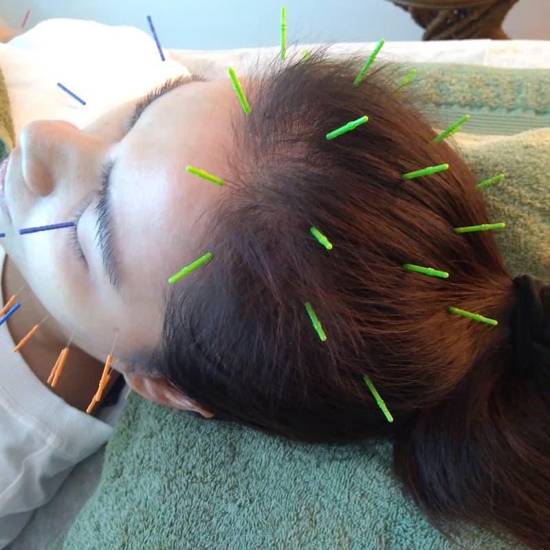 New Beauty Acupuncture sola Shinagawa Ward photo
