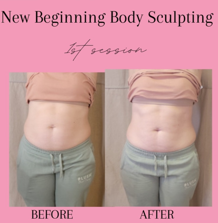 New Beginning Body Sculpting Merriam photo