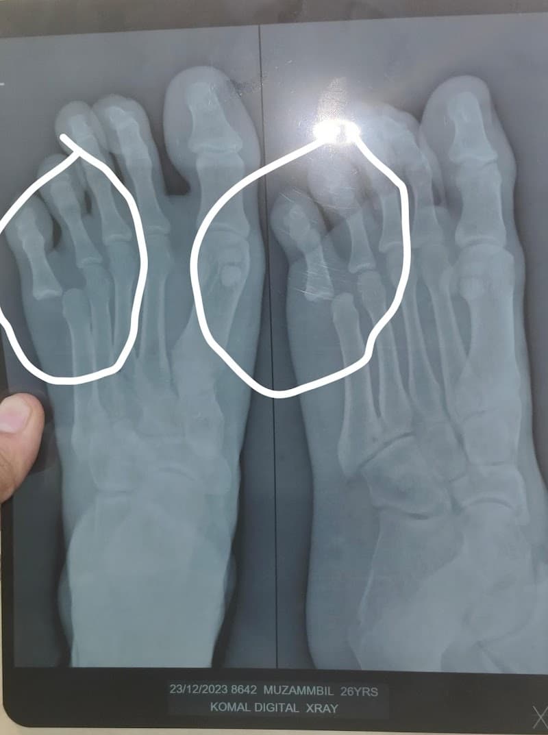 Nisar Ahmed Bone setter -hadvaidh Mumbai photo