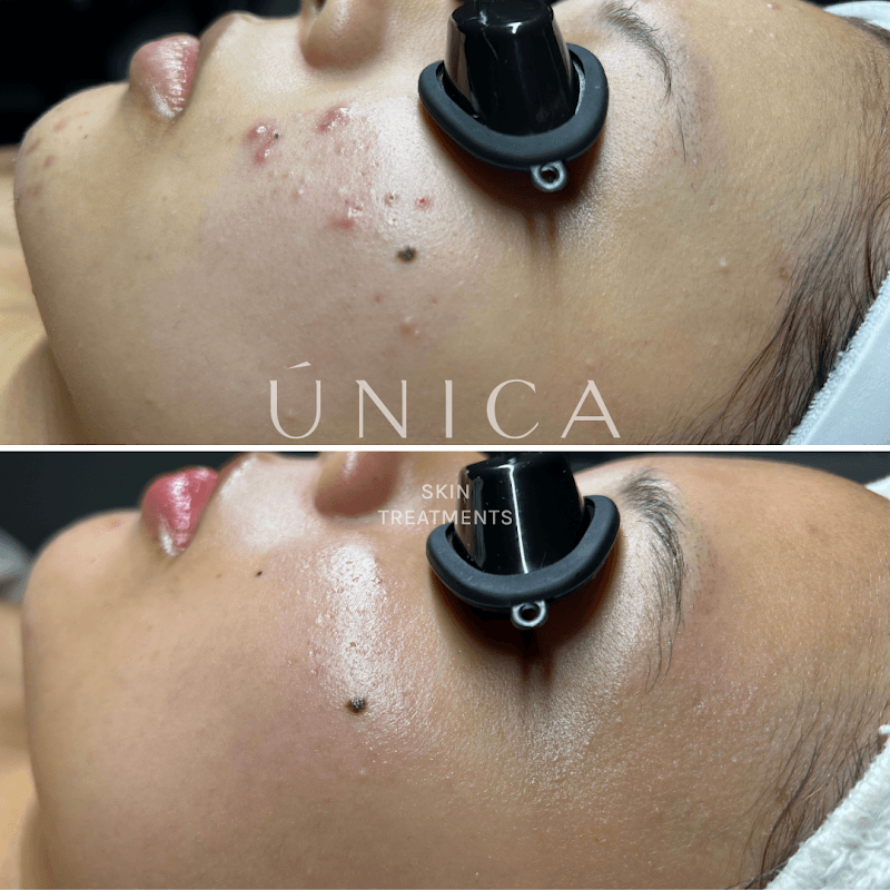 Noho Facial North Hollywood photo