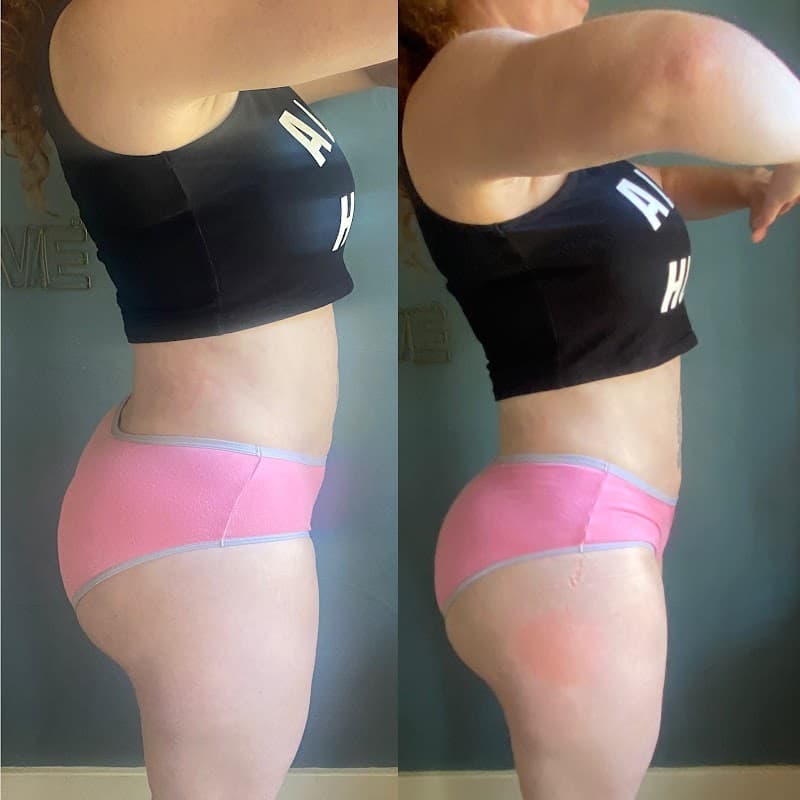 North West Body Contouring Vancouver photo