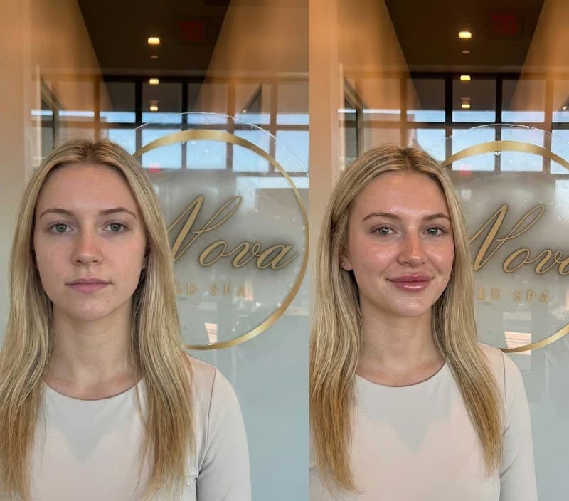Nova Laser Center New York photo