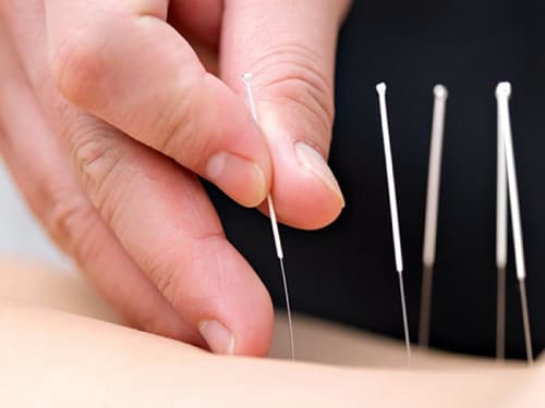 Nova Lemon King Massage | Linköping photo