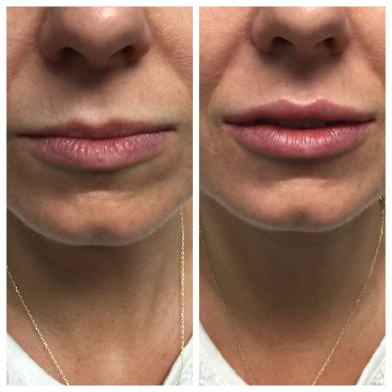 NP Choice Rejuvenation Smithtown photo