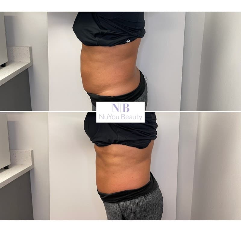 Nu You Skin Care Ambler photo