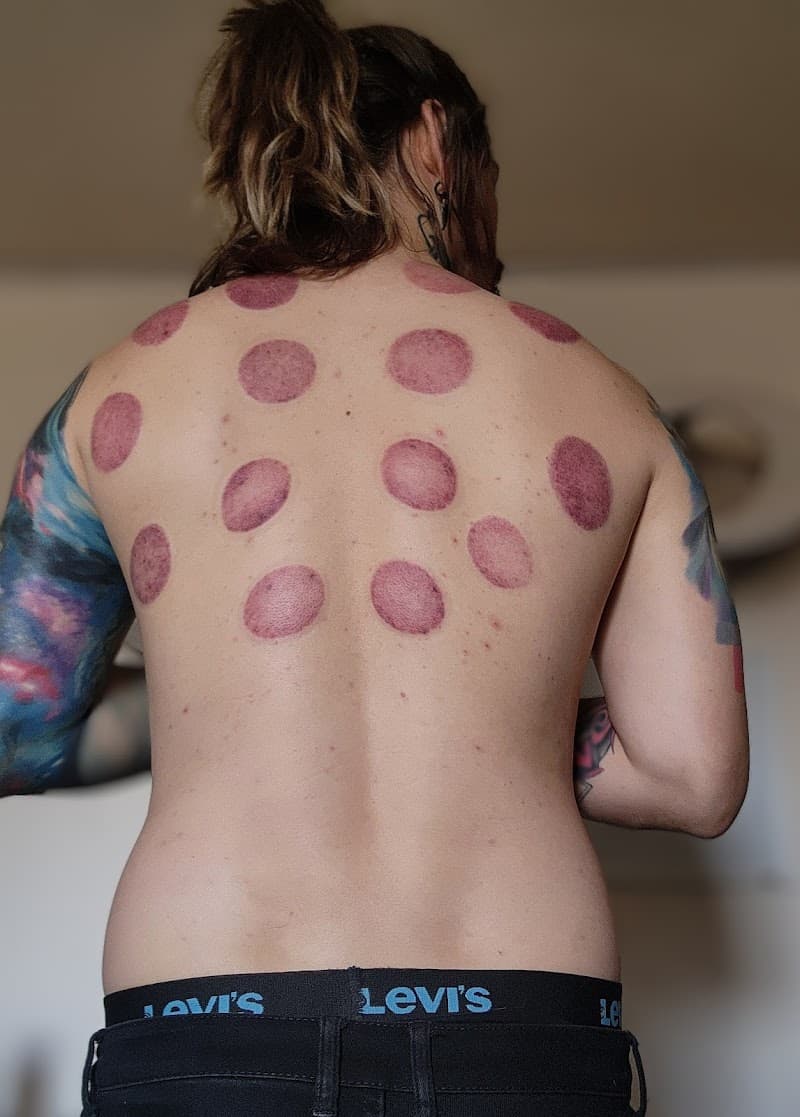 Olympic Massage Therapist Los Angeles photo