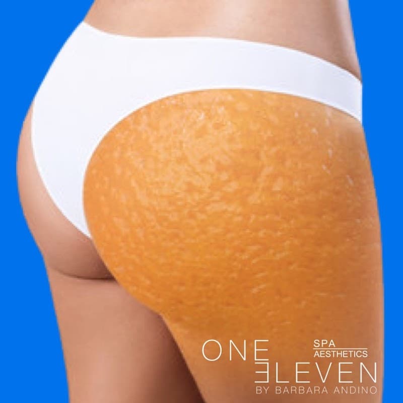 One Eleven Spa And Aesthetics Hackensack photo