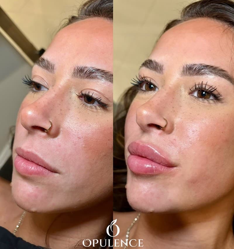 Opulence Aesthetics Jupiter photo