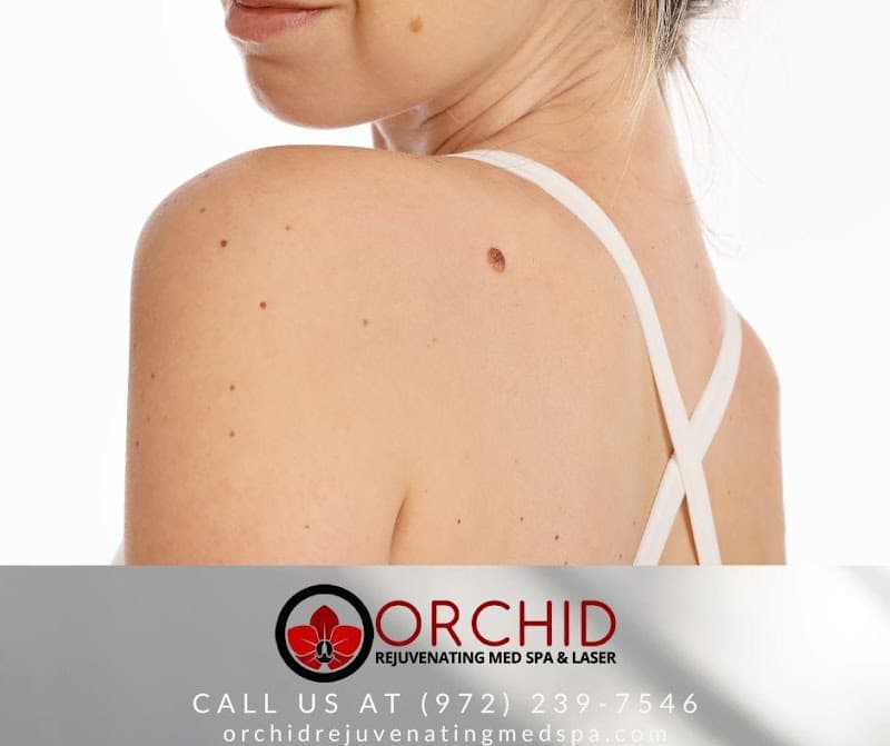 Orchid Rejuvenating Med Spa and Laser Center Dallas photo