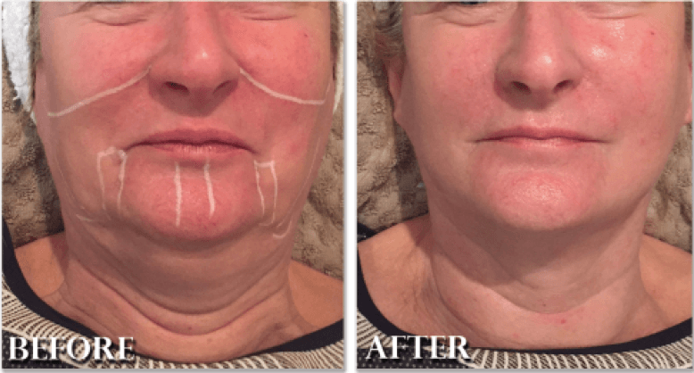 Organica Day Spa Sunshine Coast photo