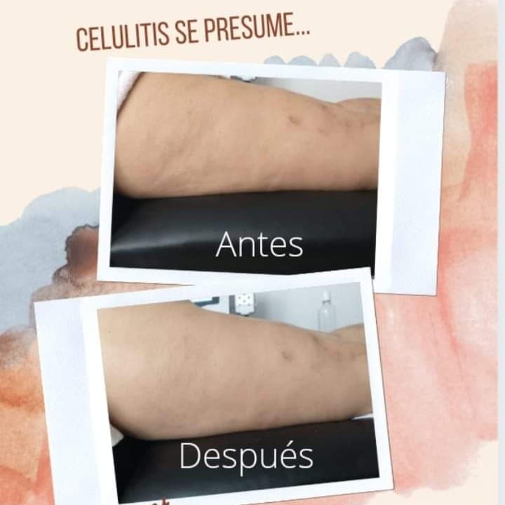 Pcis Spa Torreón photo