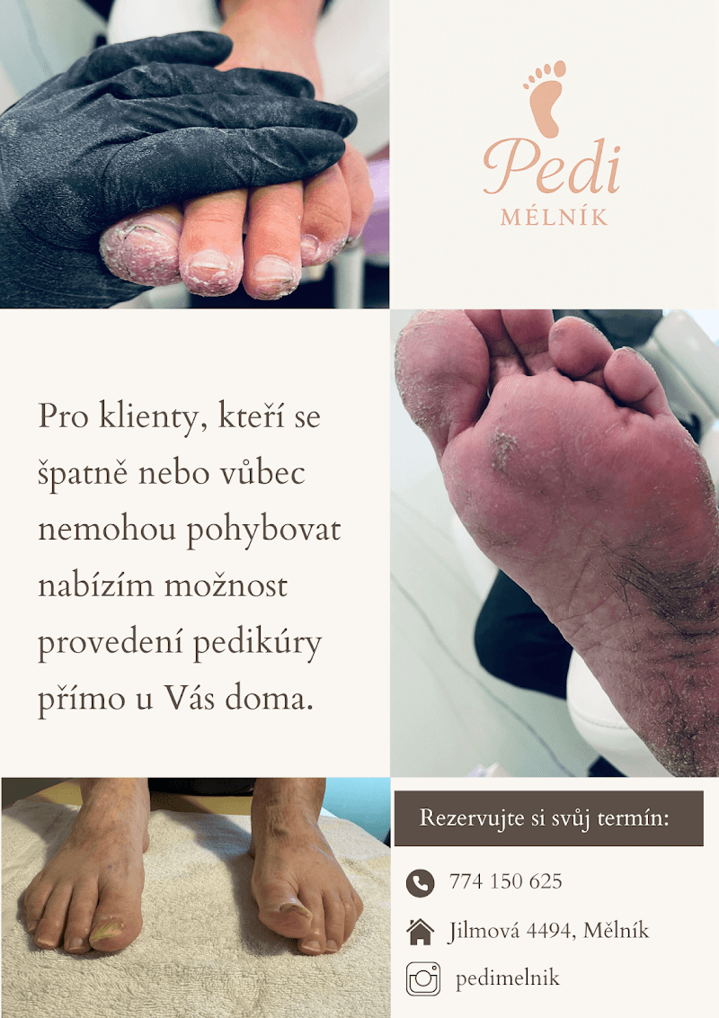 Pedi Mělník photo