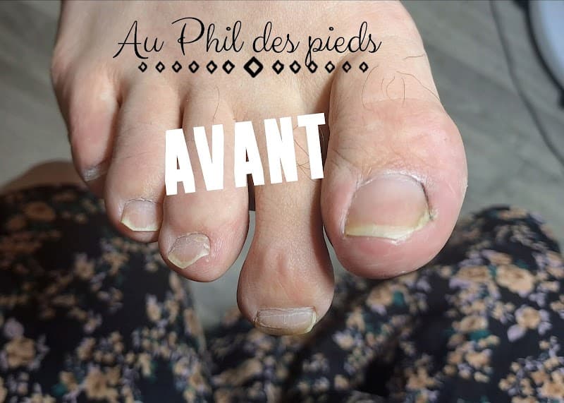 Pédicure Au Phil des Pieds Namur photo