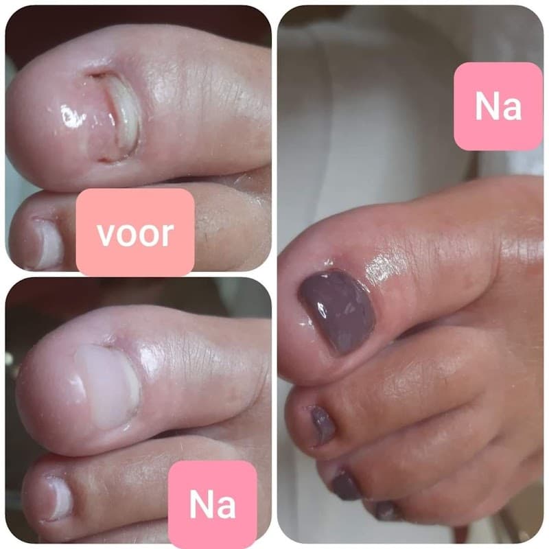 Pedicure Emmy Michiels Denderleeuw photo