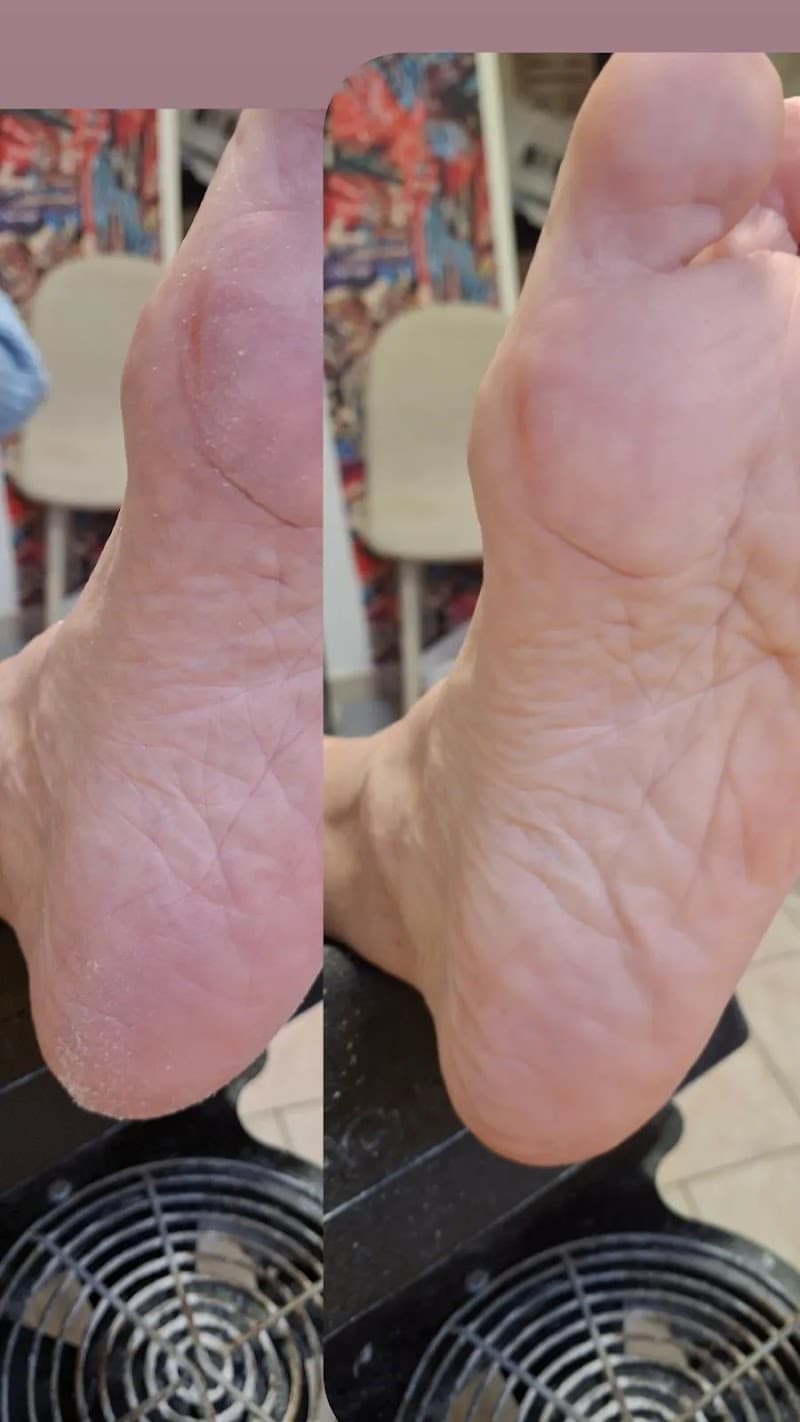 Pedikúra Osada Jirkov photo